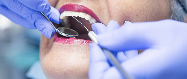 Best Emergency Tooth Extraction in Sand Lake, MI
